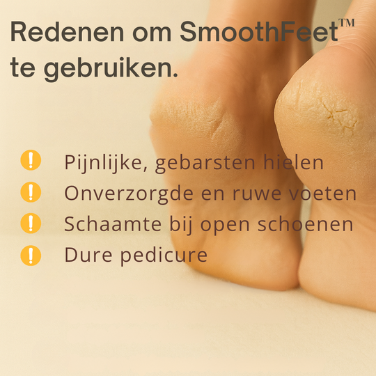 SmoothFeet™ Draadloze eeltverwijderaar